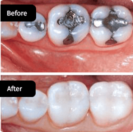 before-after-small-1 