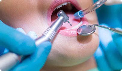 oral-surgeries-img-2