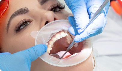 root-canal-img-3